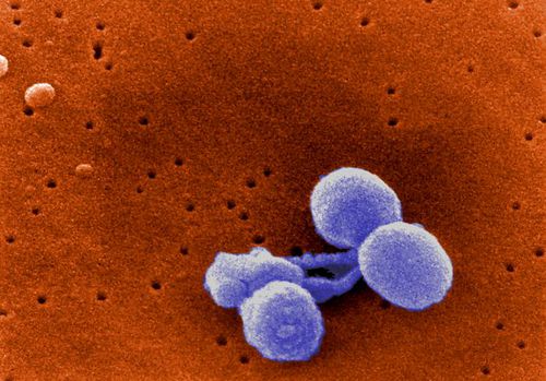  an image of the Penicillin-resistant Streptococcus pneumoniae bacteria